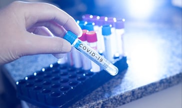 COVID-19 Diagnostic Testing Developments and the Role of Cell Rupture