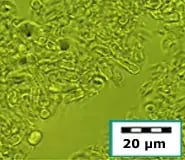 cellrupture-yeast-after (1)