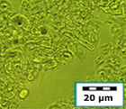 cell rupture yeast after