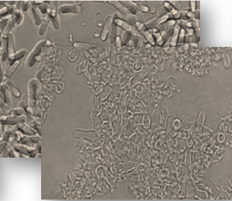 Cell Disruption - Protein